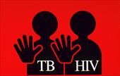 پاورپوینت عفونت همزمان سل و اچ آی وی